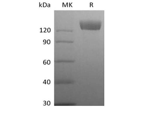 Recombinant Rhesus Macaque Angiotensin-Converting Enzyme 2/ACE-2 (C-Fc) - ABMIUM