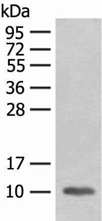 Anti-Human/Mouse/Rat FABP4 Antibody