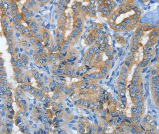 Anti-Human MUC15 Antibody