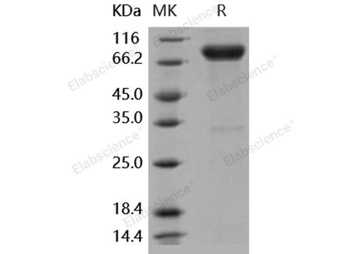 Recombinant Human IL-1R8/IL1RAPL1 Protein (Fc Tag) - ABMIUM