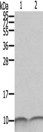 Anti-Human/Mouse/Rat S100A6 Antibody - ABMIUM