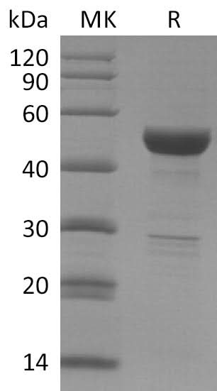 Recombinant SARS-CoV-2 Nucleocapsid Protein - ABMIUM