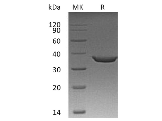 Recombinant Human STING/TMEM173 Protein (Sumo & His Tag) - ABMIUM