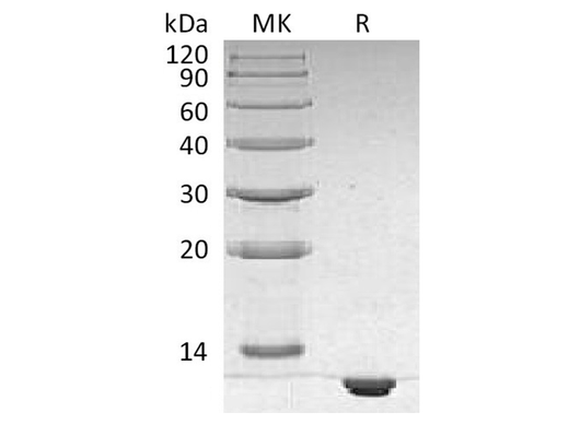 Recombinant Human S100B Protein (His Tag) - ABMIUM