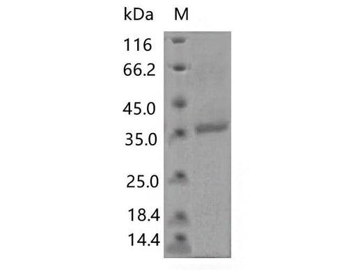 > 80 % as determined by reducing SDS-PAGE.