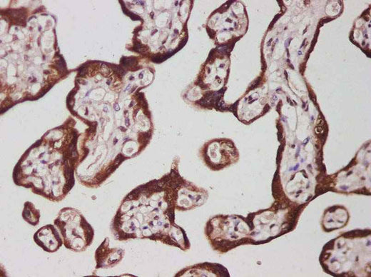 Anti-Human IL-27B Antibody - ABMIUM