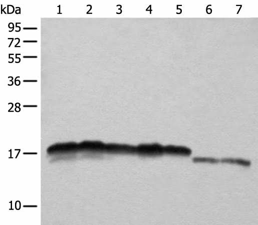 Western blot analysis of Hela HEPG2 A431 K562 and 231 cell Mouse liver tissue and Mouse brain tissue lysates using NDUFB11 Polyclonal Antibody at dilution of 1:1000