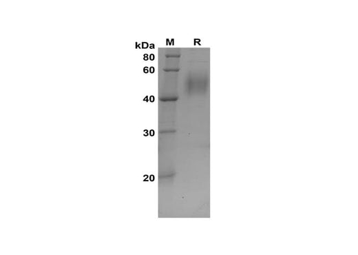 SDS-PAGE analysis of Rat IGFBP-3 proteins, 2 μg/lane of Recombinant Rat IGFBP-3 proteins was resolved with SDS-PAGE under reducing conditions, showing bands at 42-55 kDa.