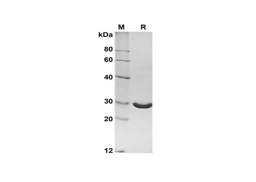 SDS-PAGE analysis of Bovine Angiopoietin-2/ANG2 proteins, 2 μg/lane of Recombinant Bovine Angiopoietin-2/ANG2 proteins was resolved with SDS-PAGE under reducing conditions, showing bands at 28 kDa.