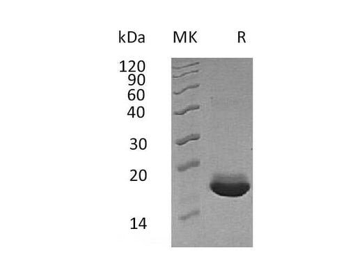Recombinant Human MANF/ARMET Protein (His Tag) - ABMIUM
