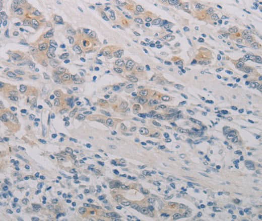 Anti-Human PTAFR Antibody - ABMIUM