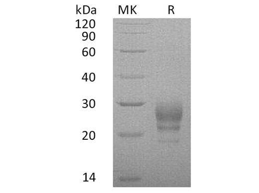 Recombinant Human Interleukin-7/IL-7 Protein (His Tag) - ABMIUM