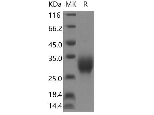 SDS-PAGE analysis of Human IL-19 proteins, 2 μg/lane of Recombinant Human IL-19 proteins was resolved with SDS-PAGE under reducing conditions, showing bands at 30 kDa.