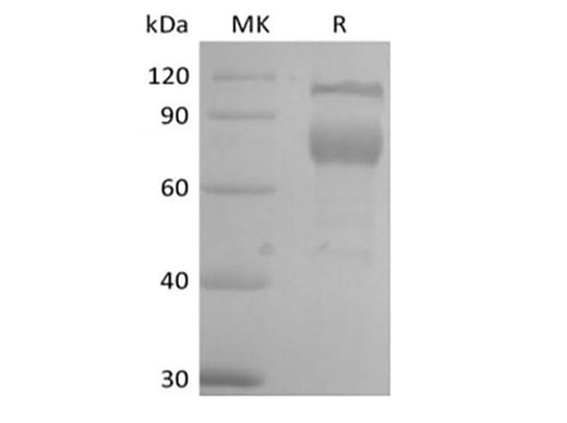 Recombinant Mouse IL-2 Receptor Subunit Beta/IL-2RB/CD122 (C-Fc) - ABMIUM