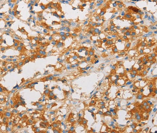 Anti-Human ART3 Antibody - ABMIUM