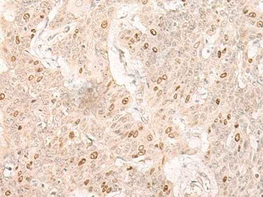 Anti-Human IL7 Antibody