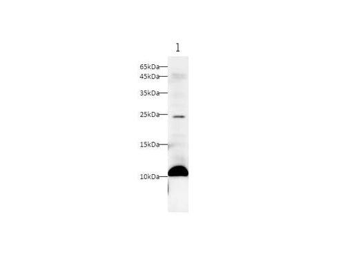Anti-Human S100A11 Antibody - ABMIUM