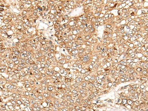 Anti-Human C1S Antibody - ABMIUM