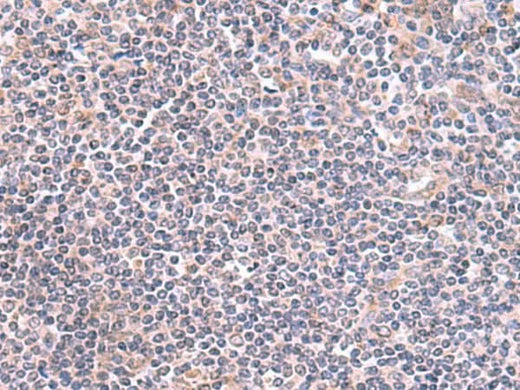 Immunohistochemistry of paraffin-embedded Human tonsil tissue using GMDS Polyclonal Antibody at dilution of 1:70(×200)