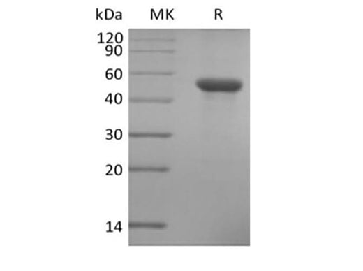 Recombinant Human ILDR2 (C-6His) - ABMIUM