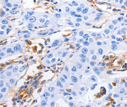 Anti-Human/Mouse/Rat MFN1 Antibody