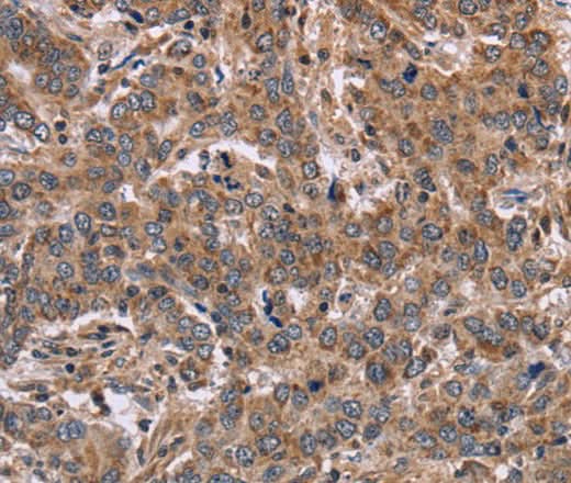 Anti-Human FAAH2 Antibody - ABMIUM