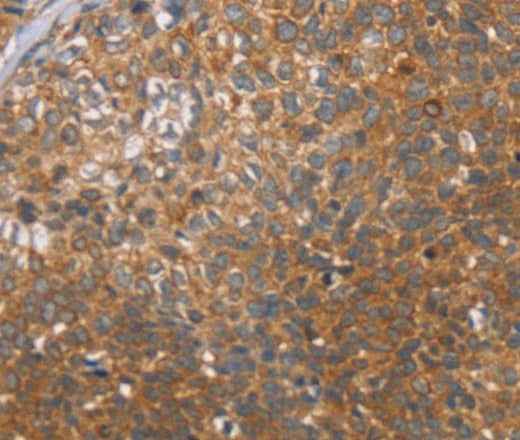 Anti-Human CCL21 Antibody