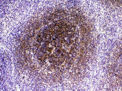 Anti-CTLA4 Antibody Picoband® Boster Bio