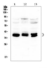 Anti-CXCR4 Antibody Picoband® Boster Bio