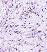 Anti-CXCL12 Antibody Boster Bio