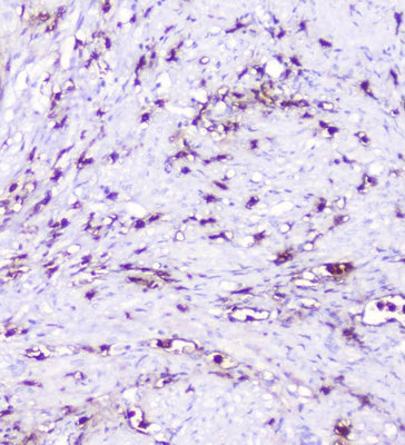 Anti-CXCL12 Antibody Boster Bio