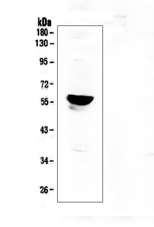 Anti-Aromatase/CYP19A1 Antibody Picoband® Boster Bio