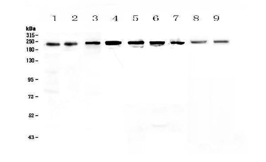 Anti-BRG1/SMARCA4 Antibody Picoband® Boster Bio