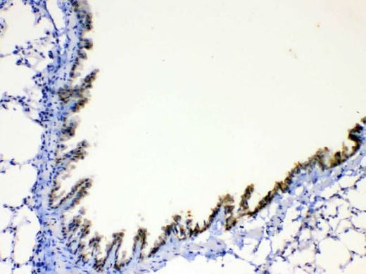 Anti-AGRP Antibody Boster Bio