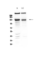 Anti-BMPR2 Antibody Picoband® Boster Bio
