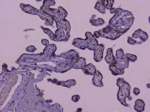 Anti-CIC Antibody Boster Bio