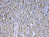 Anti-GST3/GST pi/Gstp1 Antibody Picoband® Boster Bio