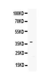 Anti-IGFBP3 Antibody Picoband® Boster Bio