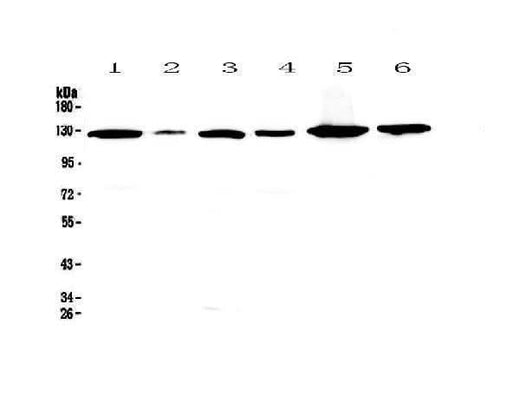Anti-VEGF Receptor 1/FLT1 Antibody Picoband® Boster Bio