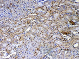 Anti-XRCC1 Antibody Picoband® Boster Bio