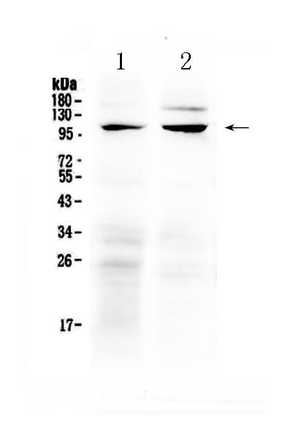 Anti-TRPC6 Antibody Picoband® Boster Bio
