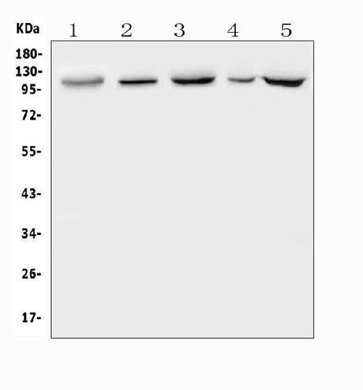 Anti-Polycystin 2/PKD2 Antibody Picoband® Boster Bio