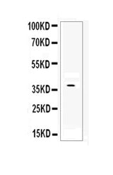 Anti-DKK1 Antibody Picoband® Boster Bio