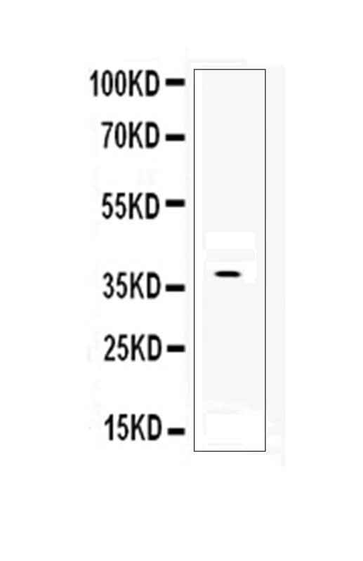 Anti-DKK1 Antibody Picoband® Boster Bio