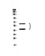 Anti-TIM 3/HAVCR2 Antibody Picoband® Boster Bio