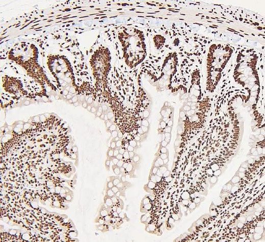 Anti-DDX5 Antibody Picoband® Boster Bio