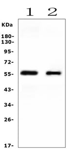 Anti-Cytochrome P450 2E1/CYP2E1 Antibody Picoband® Boster Bio