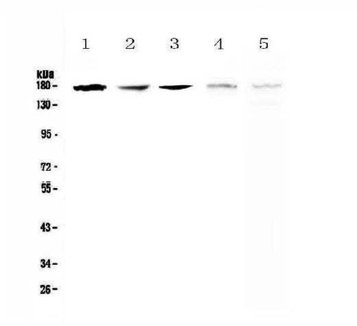 Anti-IRE1/ERN1 Antibody Picoband® Boster Bio