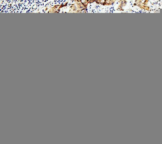 Anti-Zinc finger protein GLI2 GLI2 Antibody Picoband® Boster Bio