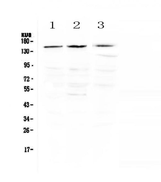 Anti-TrkA/NTRK1 Antibody Picoband® Boster Bio